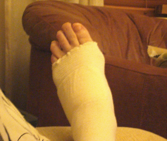 Poorly Foot